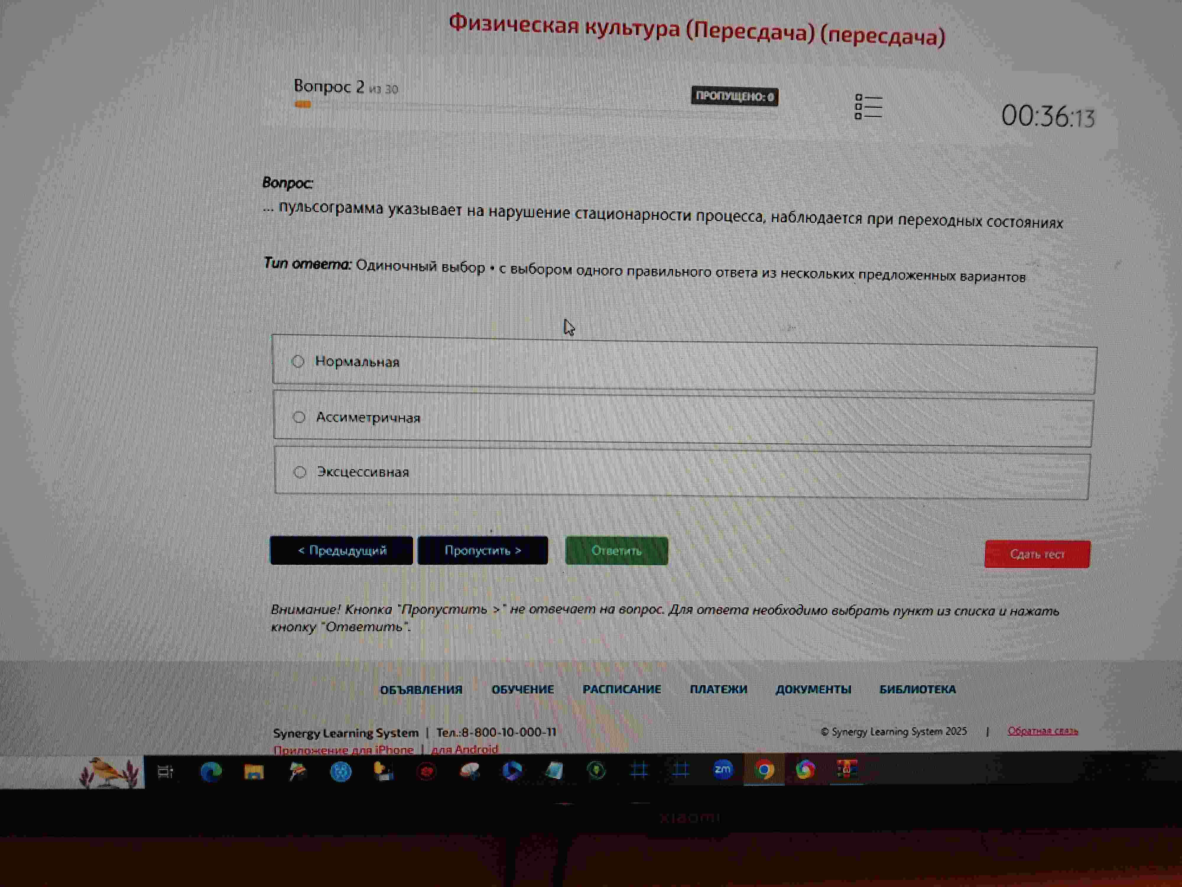 Фото задания: Пульсограмма указывает на нарушение стационарности процесса, наблюдается при переходных состояниях.