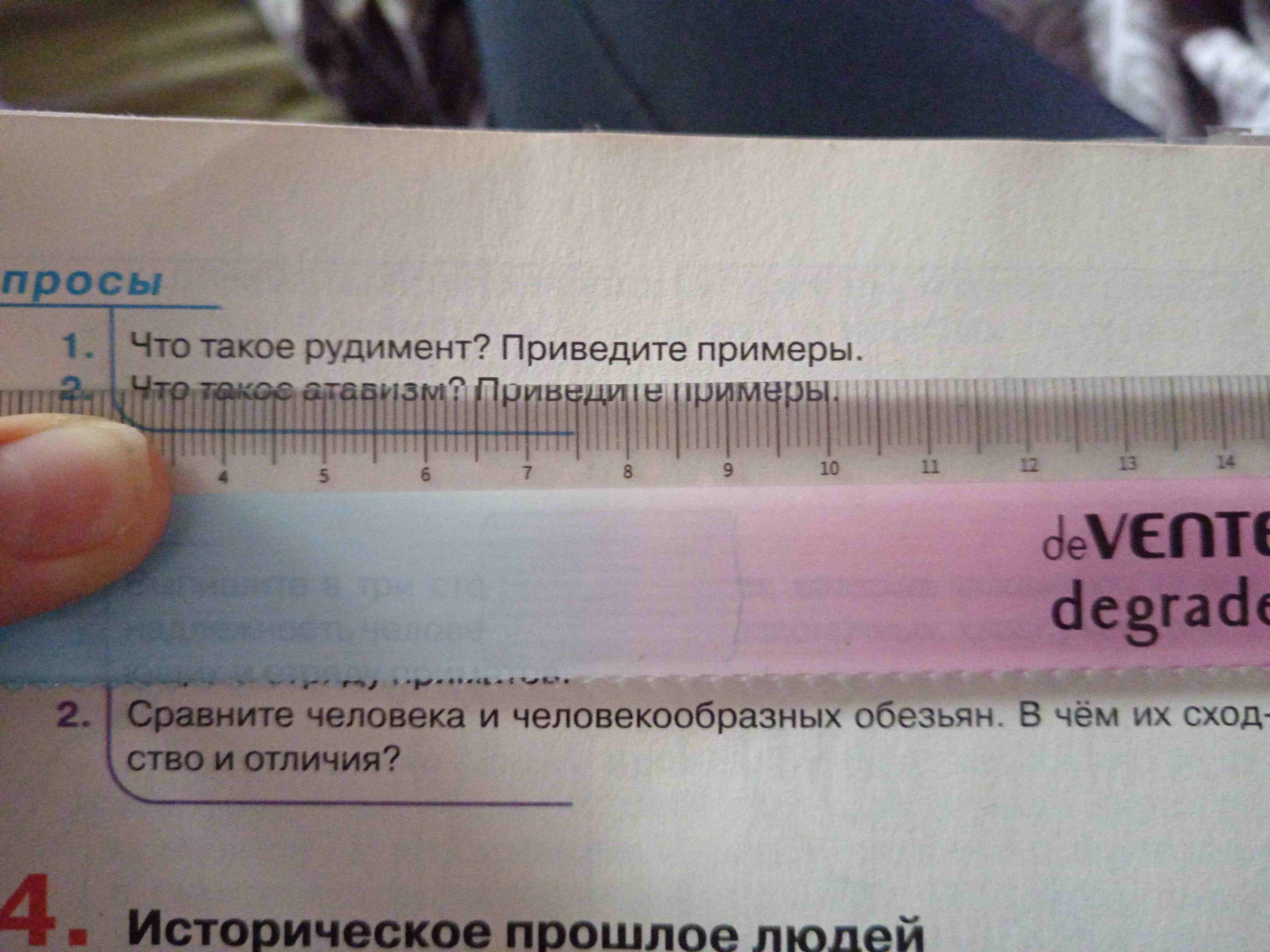 Фото задания: Что такое рудимент? Приведите примеры.