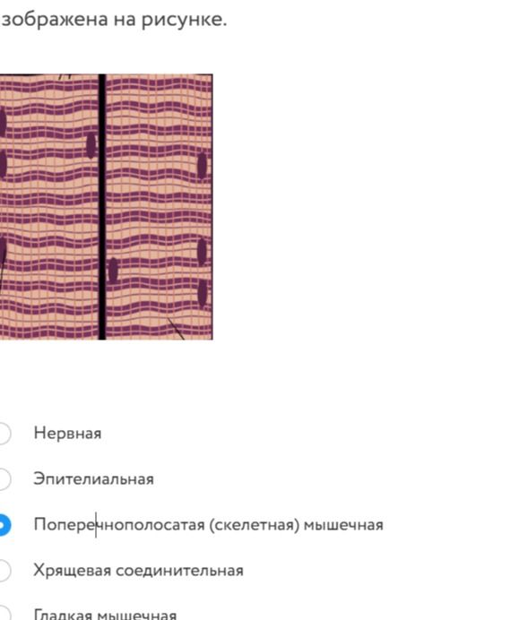 Фото задания: [Начало вопроса обрезано] изображена на рисунке. Варианты: нервная; эпителиальная; поперечнополосатая (скелетная) мышечная;…