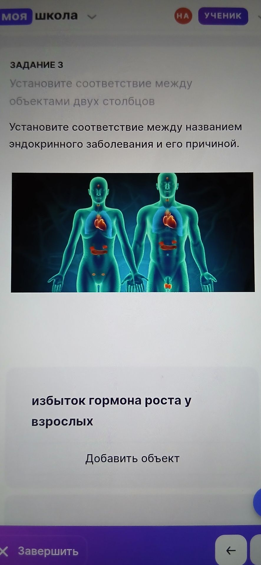 Фото задания: Задание 3. Установите соответствие между названием эндокринного заболевания и его причиной. Причина: избыток гормона роста…