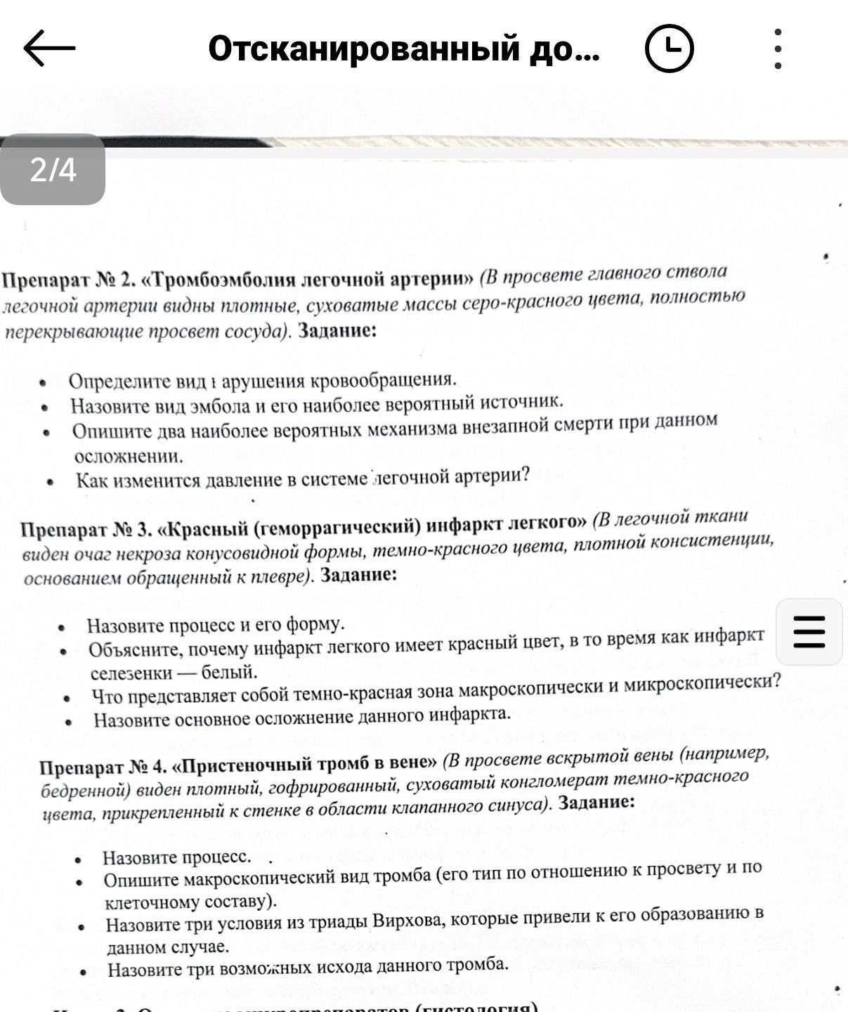 Фото задания: Препарат № 4. «Пристеночный тромб в вене» (в просвете вскрытой вены, например бедренной, виден плотный, гофрированный,…