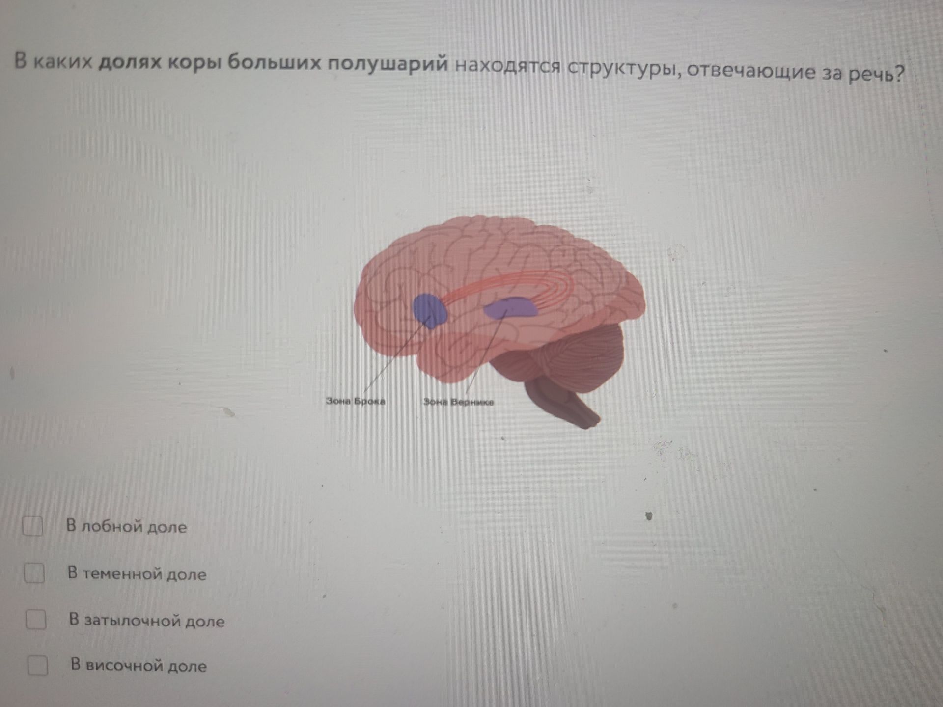 Фото задания: В каких долях коры больших полушарий находятся структуры, отвечающие за речь? В лобной доле; в теменной доле; в затылочной…