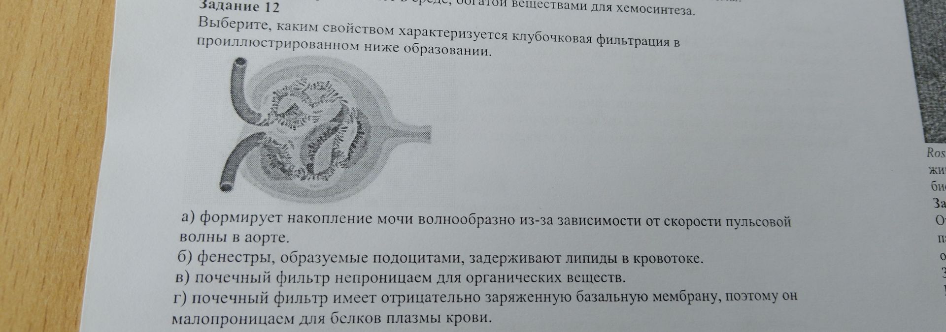 Фото задания: Задание 12. Выберите, каким свойством характеризуется клубочковая фильтрация в проиллюстрированном ниже образовании. а)…